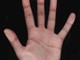 Savona: la mano protagonista al “48° Congresso nazionale società italiana di chirurgia della mano”