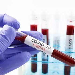 Coronavirus: continuano a diminuire i positivi, ma crescono i nuovi contagi individuati nelle ultime 24 ore (+15)